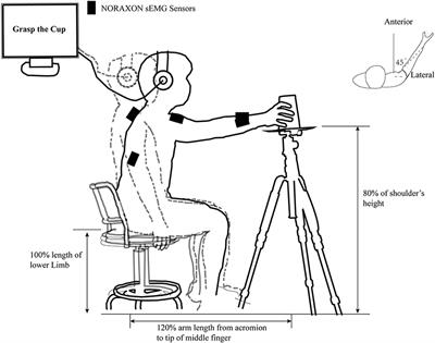 Startle Increases the Incidence of Anticipatory Muscle Activations but Does Not Change the Task-Specific Muscle Onset for Patients After Subacute Stroke